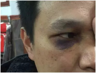 送餐員鄭先生被毆打的慘狀 送餐員鄭先生被毆打的慘狀