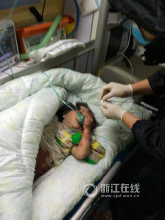 小女孩在醫(yī)院接受治療。