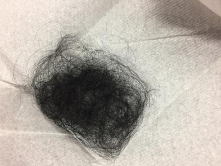 女子被房東扯下頭發(fā)。(美國《世界日?qǐng)?bào)》/俞姝含 攝)