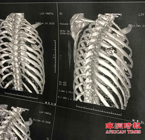 （南非《非洲時報》）