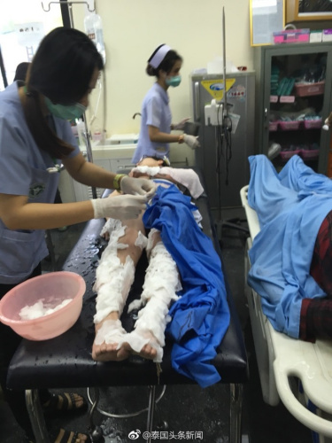 泰國皮皮島附近一快艇突發(fā)爆炸，多名中國人受傷(圖：泰國頭條新聞微博)