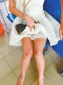 四川游客花花這次越南游落得滿身傷痕