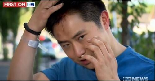 中國僑網(wǎng)陳基思展示受傷的頭部。(新西蘭天維網(wǎng)援引澳洲九號臺圖片)