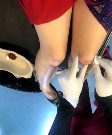 中國(guó)僑網(wǎng)希臘醫(yī)生幫助Maya處理傷口。(意大利歐聯(lián)網(wǎng))