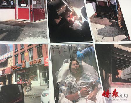 中國僑網(wǎng)陳秀貞手術(shù)圖片以及事發(fā)現(xiàn)場圖片。(美國《僑報》/傷者提供 張晶翻拍)