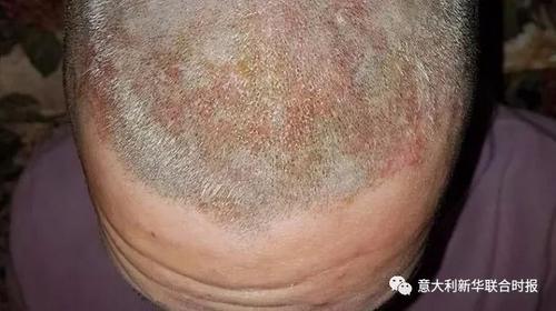 中國僑網(wǎng)(資料圖:意大利《新華聯(lián)合時(shí)報(bào)》微信公眾號(hào))