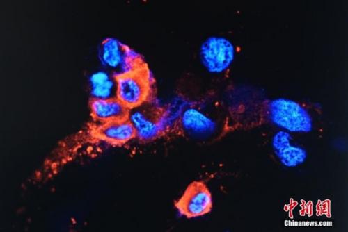 中國僑網(wǎng)圖為香港大學(xué)團(tuán)隊(duì)分離出的奧密克戎變異病毒株。中新社記者 陳永諾 攝