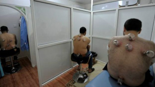 利比亞班加西一家拔火罐的診所。(英國《BBC中文網(wǎng)》資料圖)